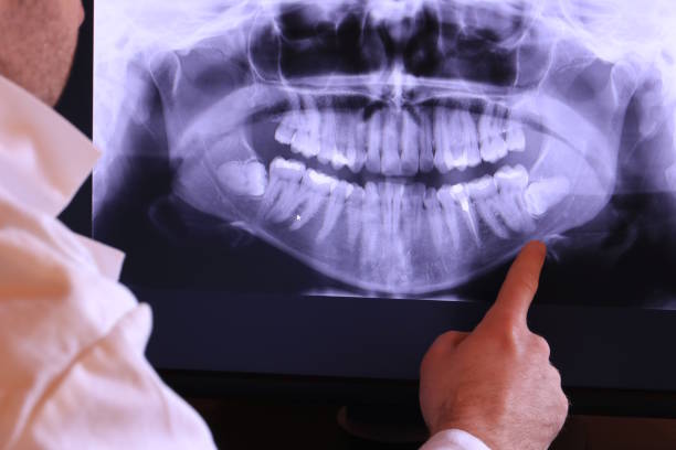 Best Emergency Denture Repair in Northwest Harborcreek, PA