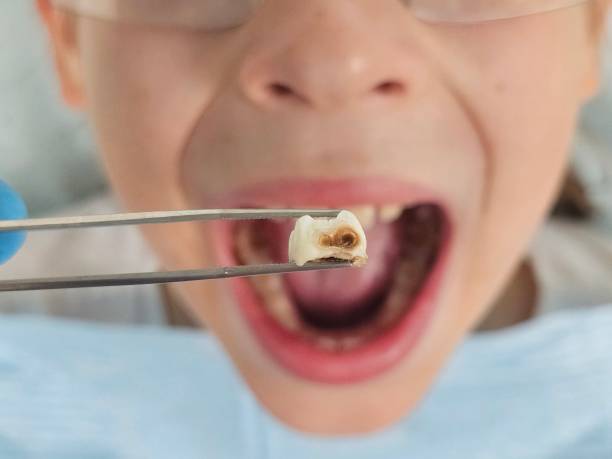 Best Emergency TMJ Treatment in Northwest Harborcreek, PA